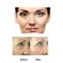 Derma roller - test arc szemek - 3in1 arany - 4